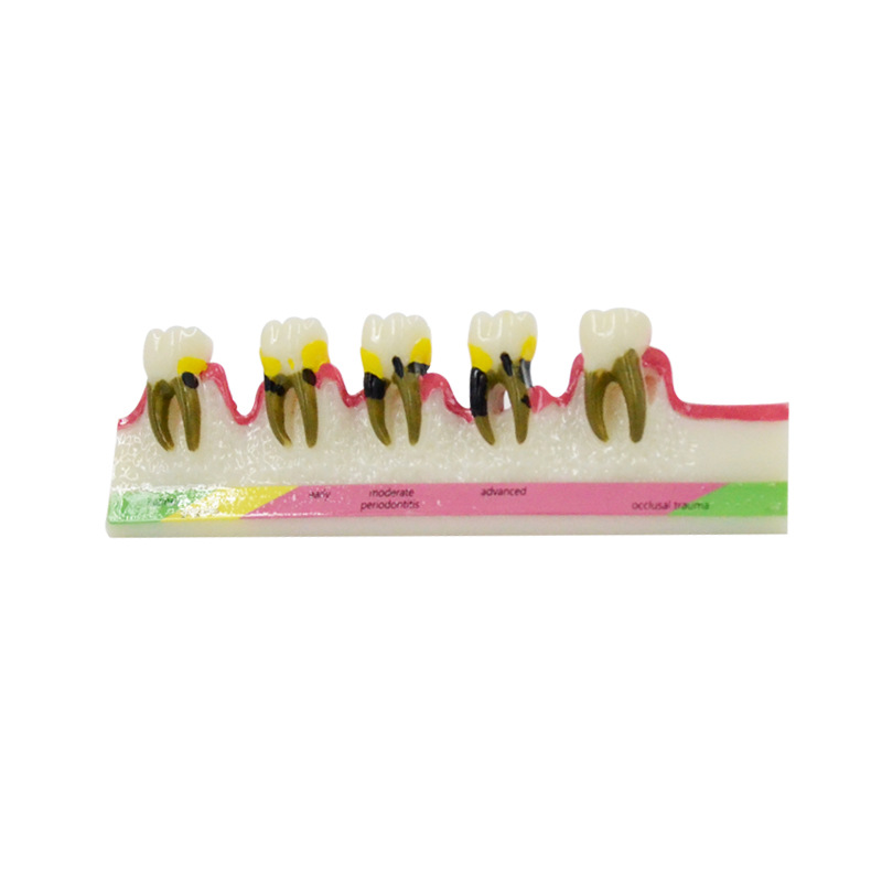 Periodontal Disease Model Dent - огляд і ціна Medical Lab Study