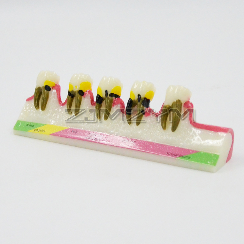 Periodontal Disease Model Dent - огляд і ціна Medical Lab Study
