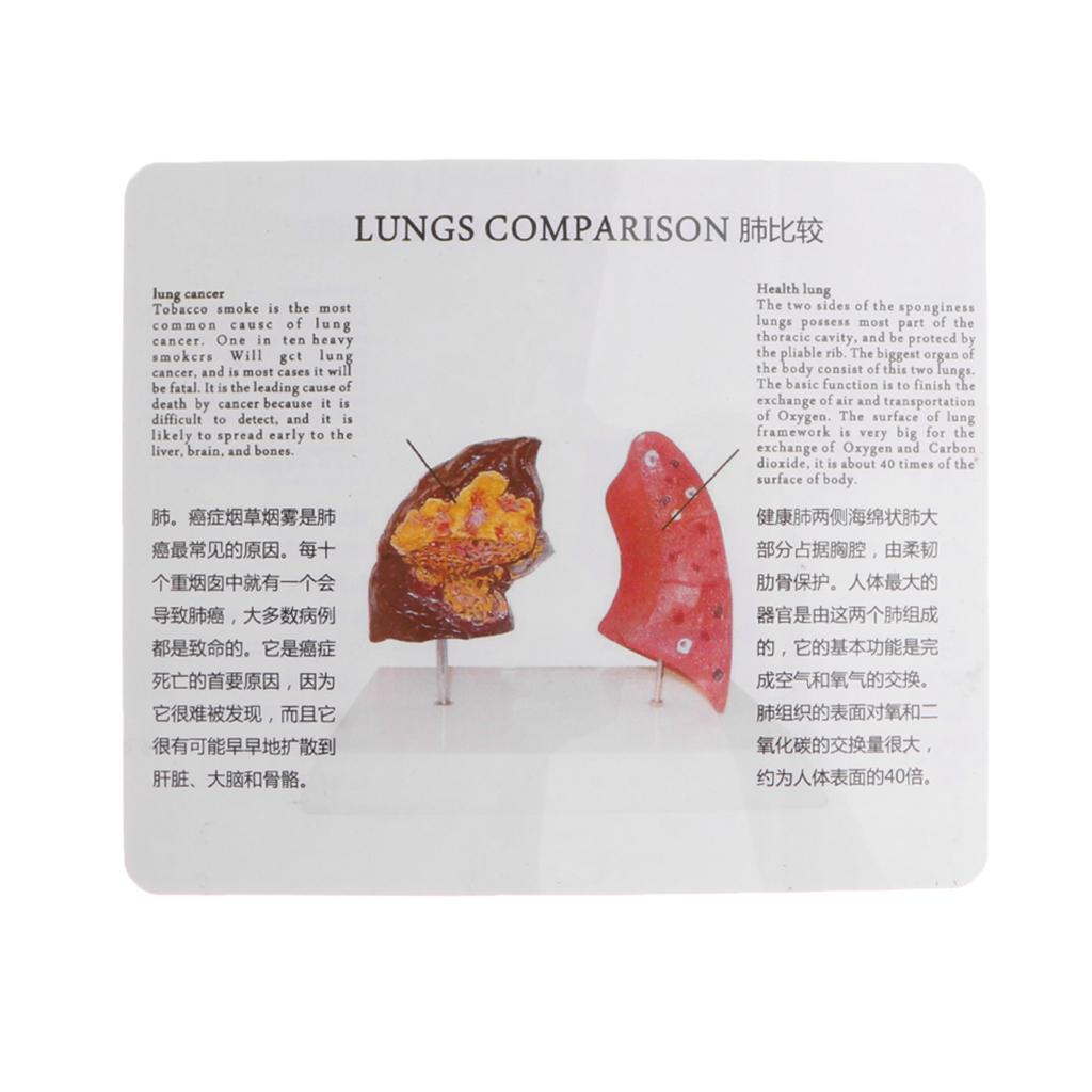 Human Lung Normal Comparison M - огляд і ціна Medical Lab Supplies